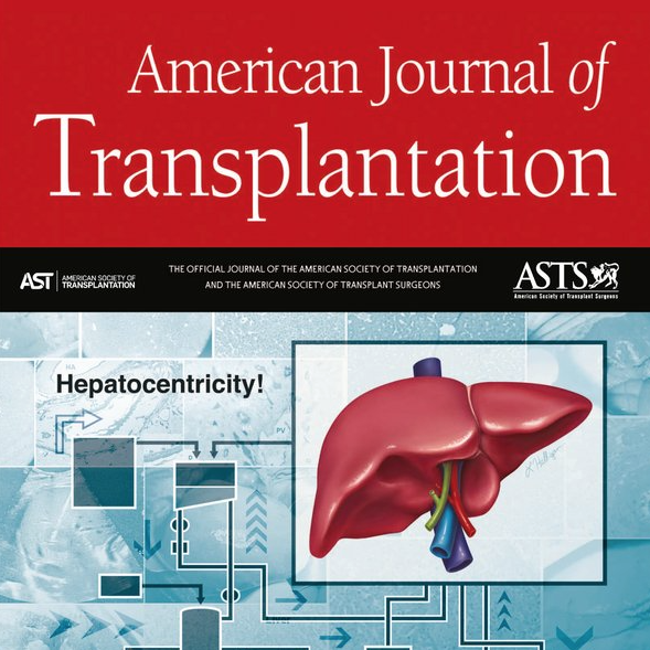 Use of Population-based Data to Demonstrate How Waitlist-based Metrics Overestimate Geographic Disparities in Access to Liver Transplant Care.